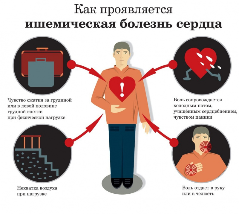 Как выглядит сердечный приступ у человека Статьи