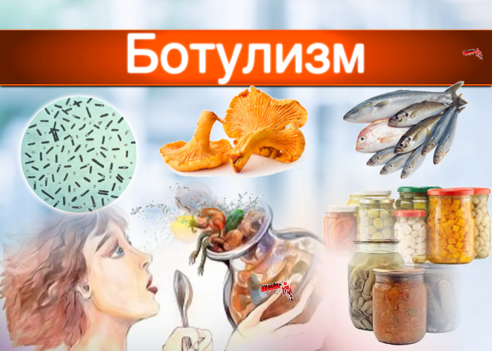 Не допустить и не пропустить бомбаж!   Советы по профилактике ботулизма