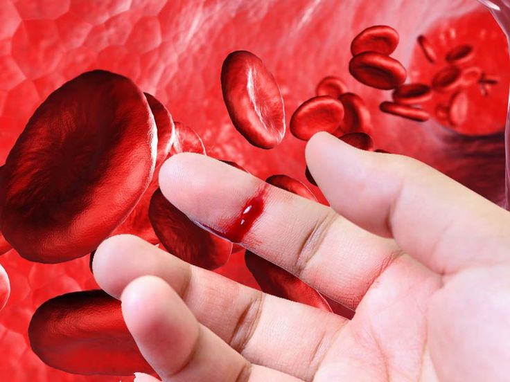 17 апреля - Всемирный день борьбы с гемофилией - рассказываем подробно 